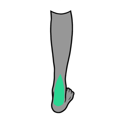 Image for choice number 13