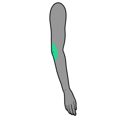 Image for choice number 6